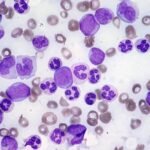 giemsa stain