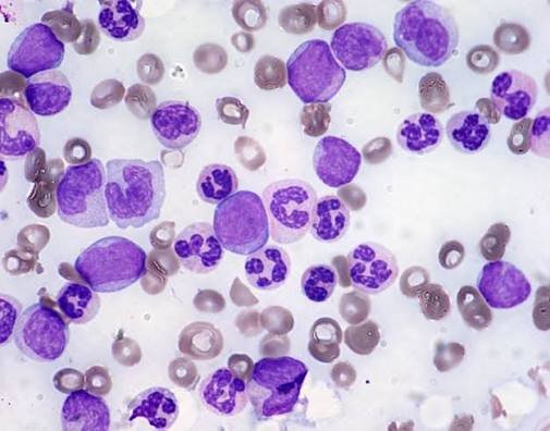 giemsa stain