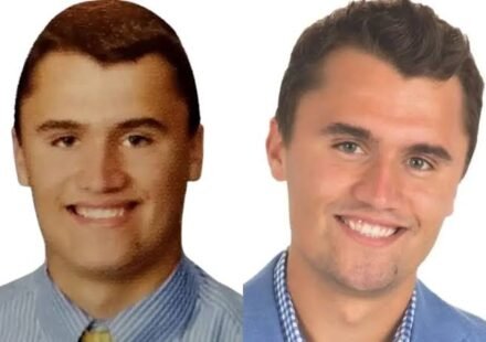 charlie kirk teeth