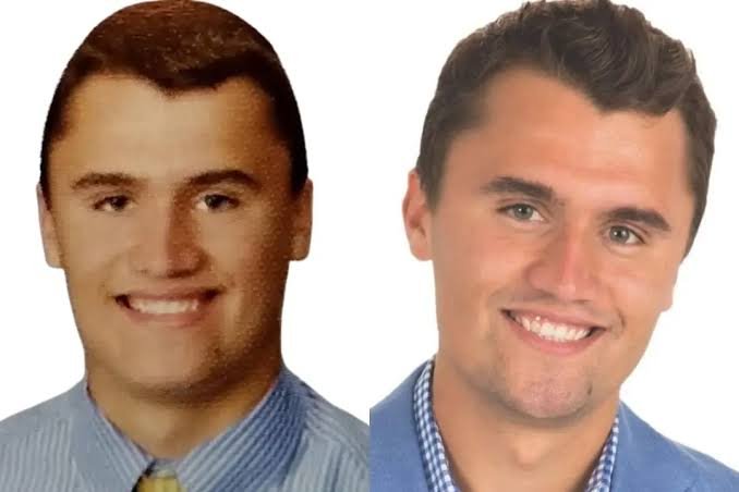 charlie kirk teeth